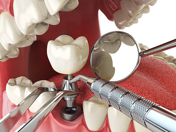 Best Emergency Treatment for Oral Infections in East Sandwich, MA